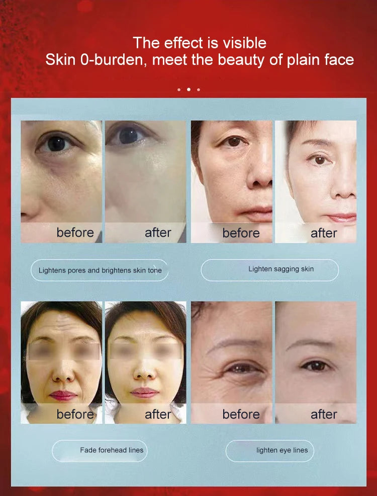 2025 Newest Portable Anti-Aging Collagen Gun for Face Lift Wrinkle Removal RF Tightening Skin